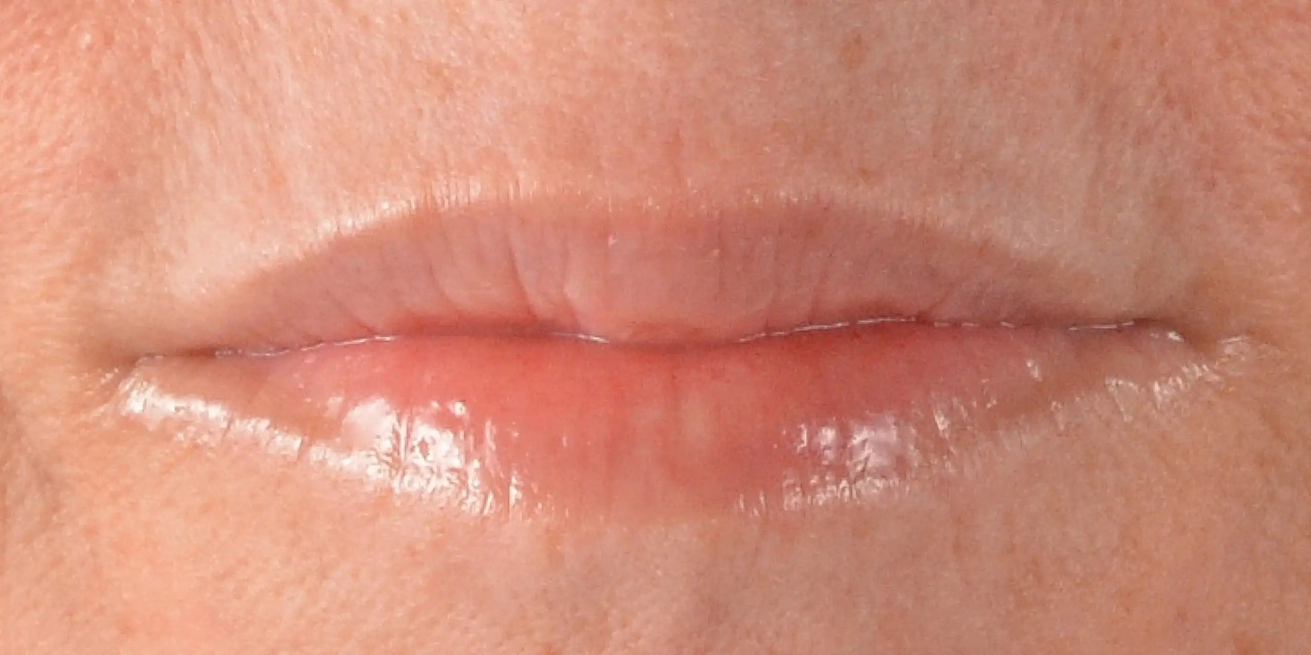 Alt text not provided for this image