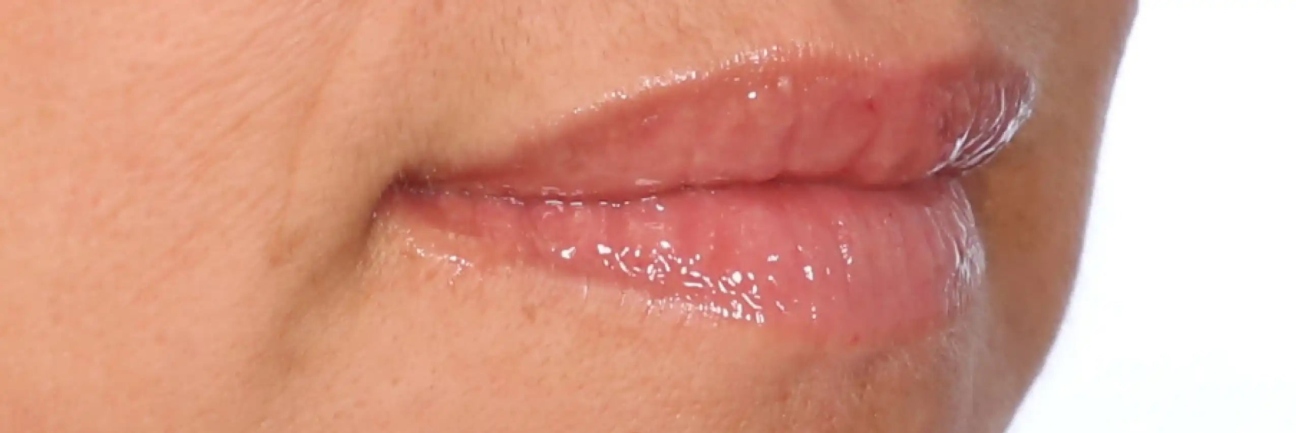 Alt text not provided for this image