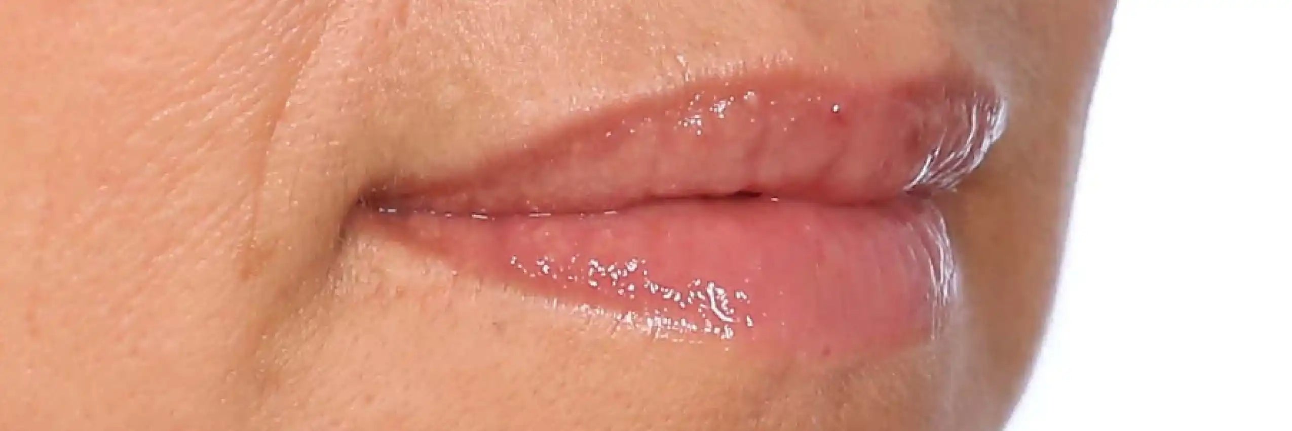 Alt text not provided for this image