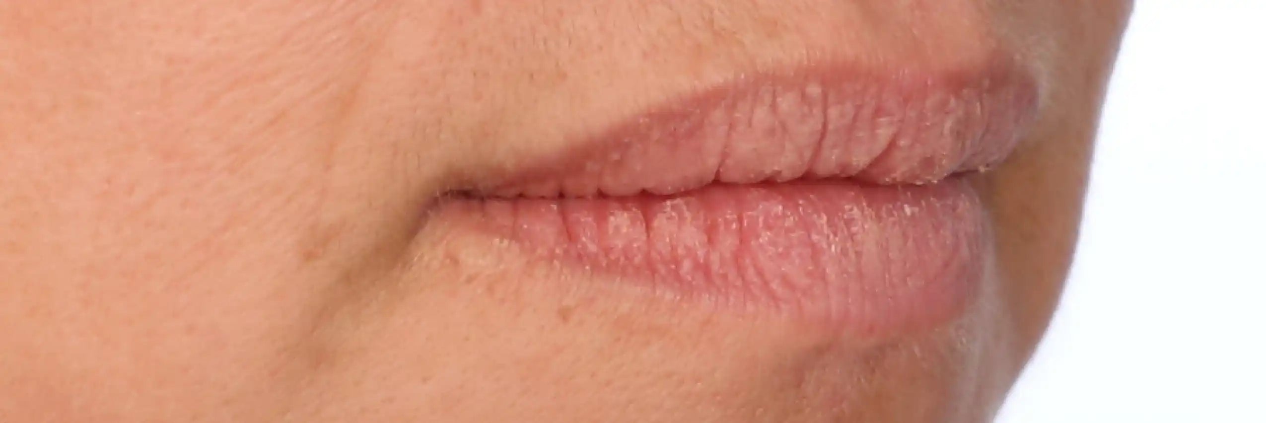 Alt text not provided for this image