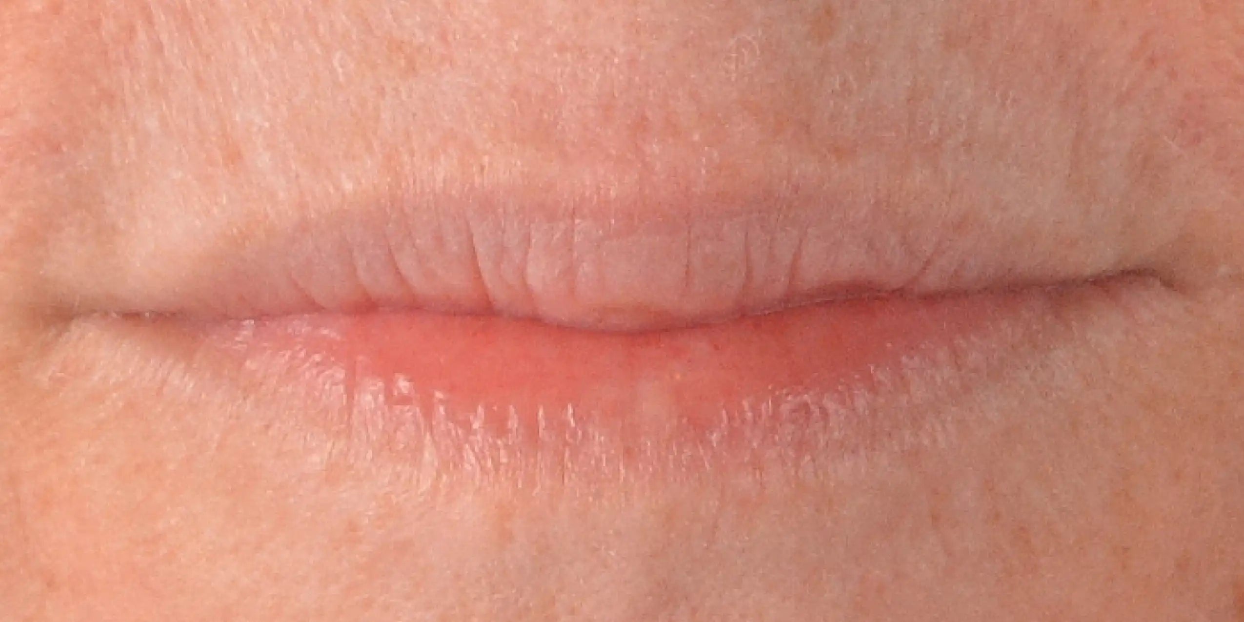 Alt text not provided for this image