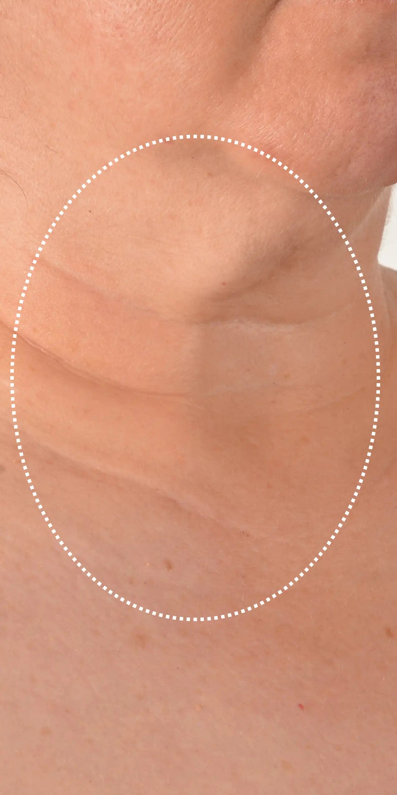 Alt text not provided for this image