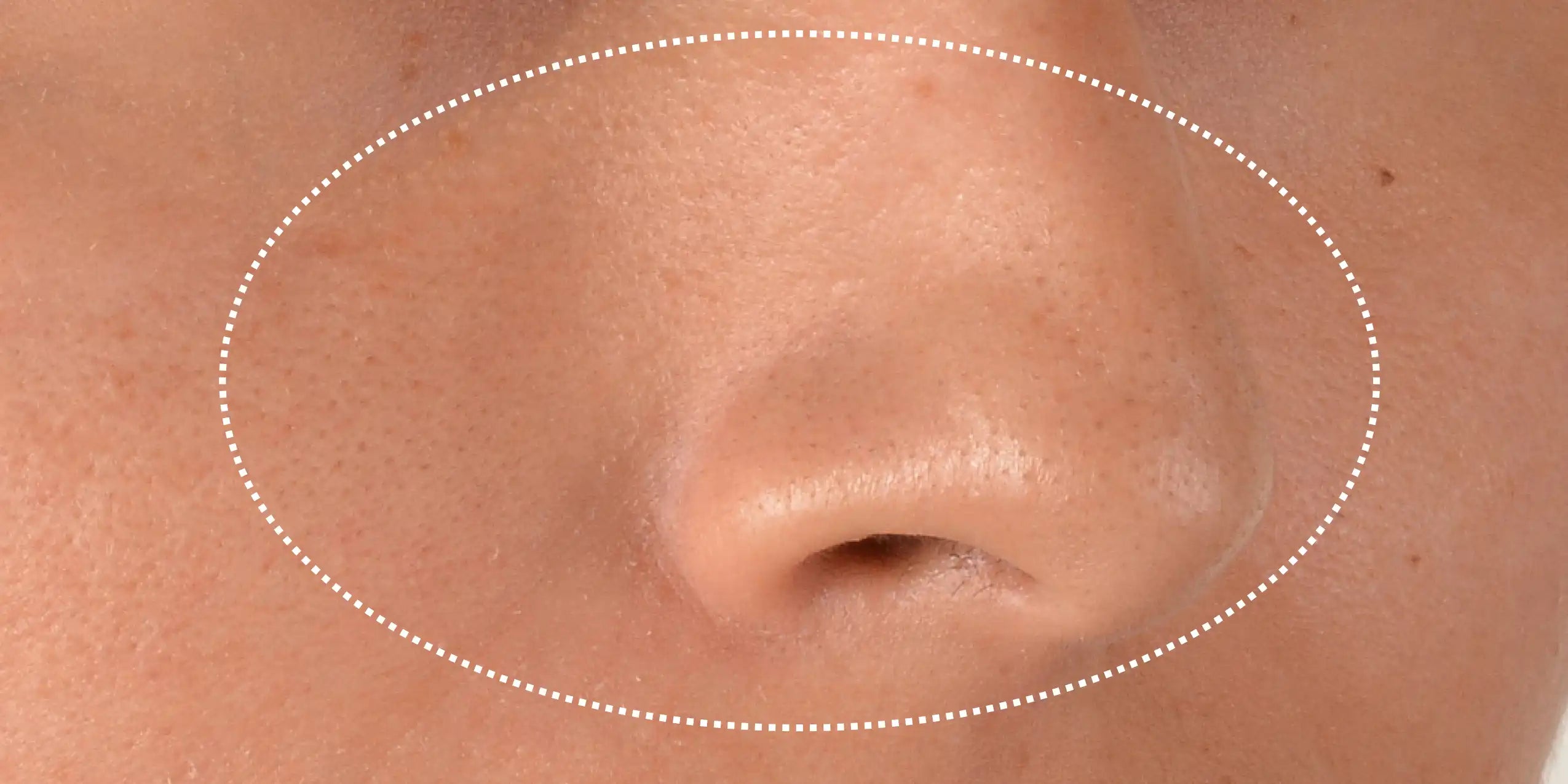 Alt text not provided for this image