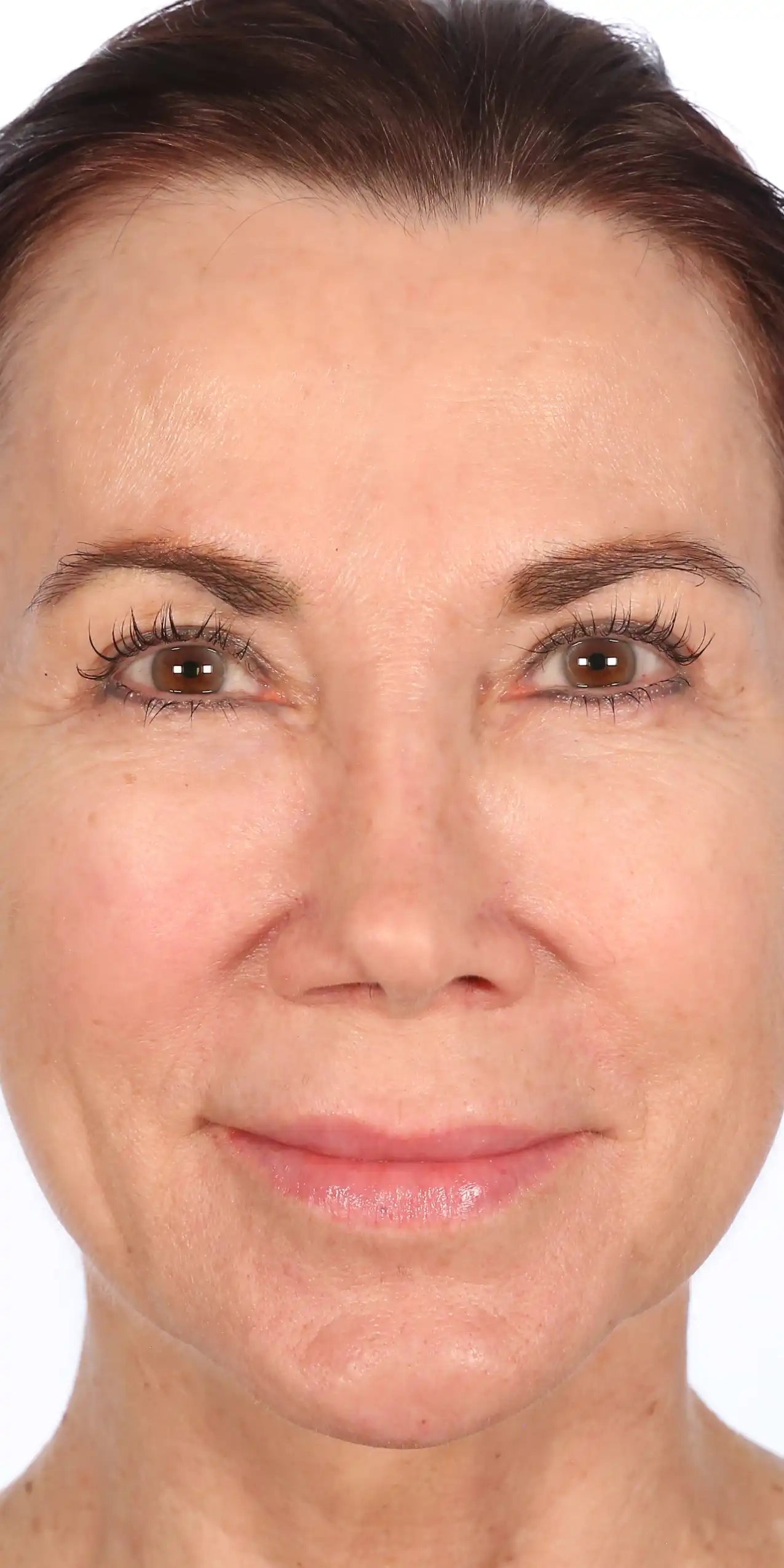 Alt text not provided for this image