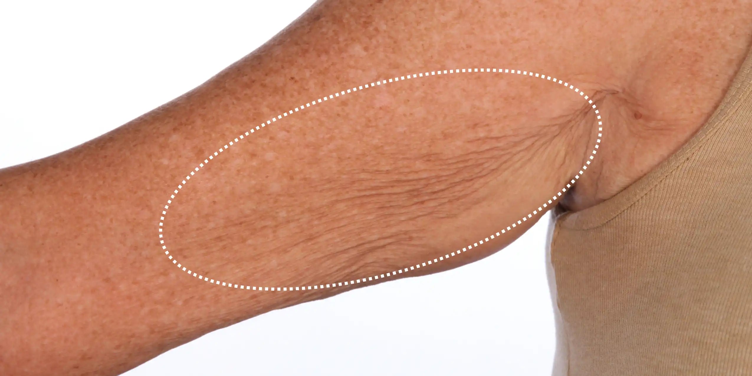 Alt text not provided for this image