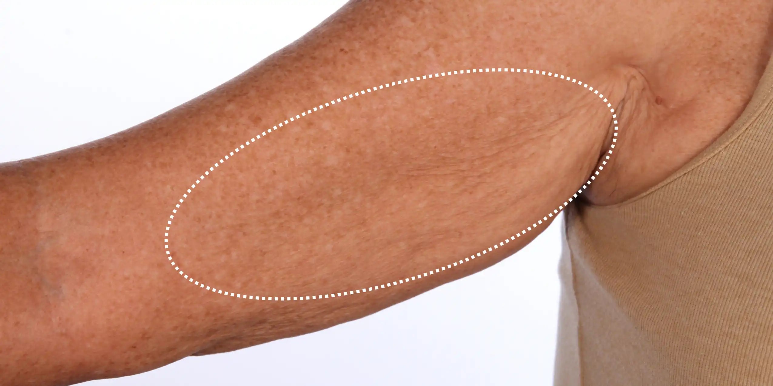 Alt text not provided for this image