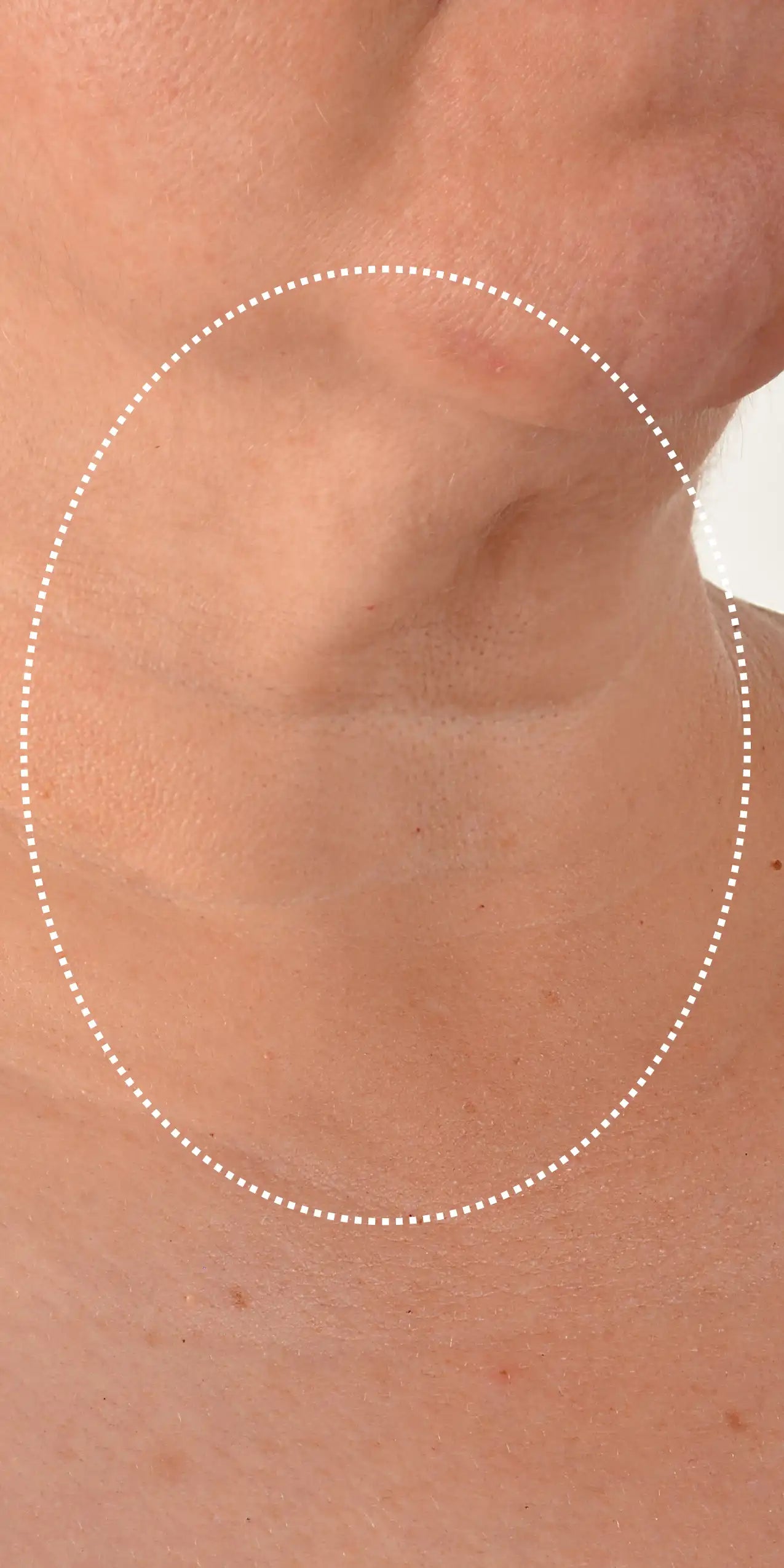 Alt text not provided for this image