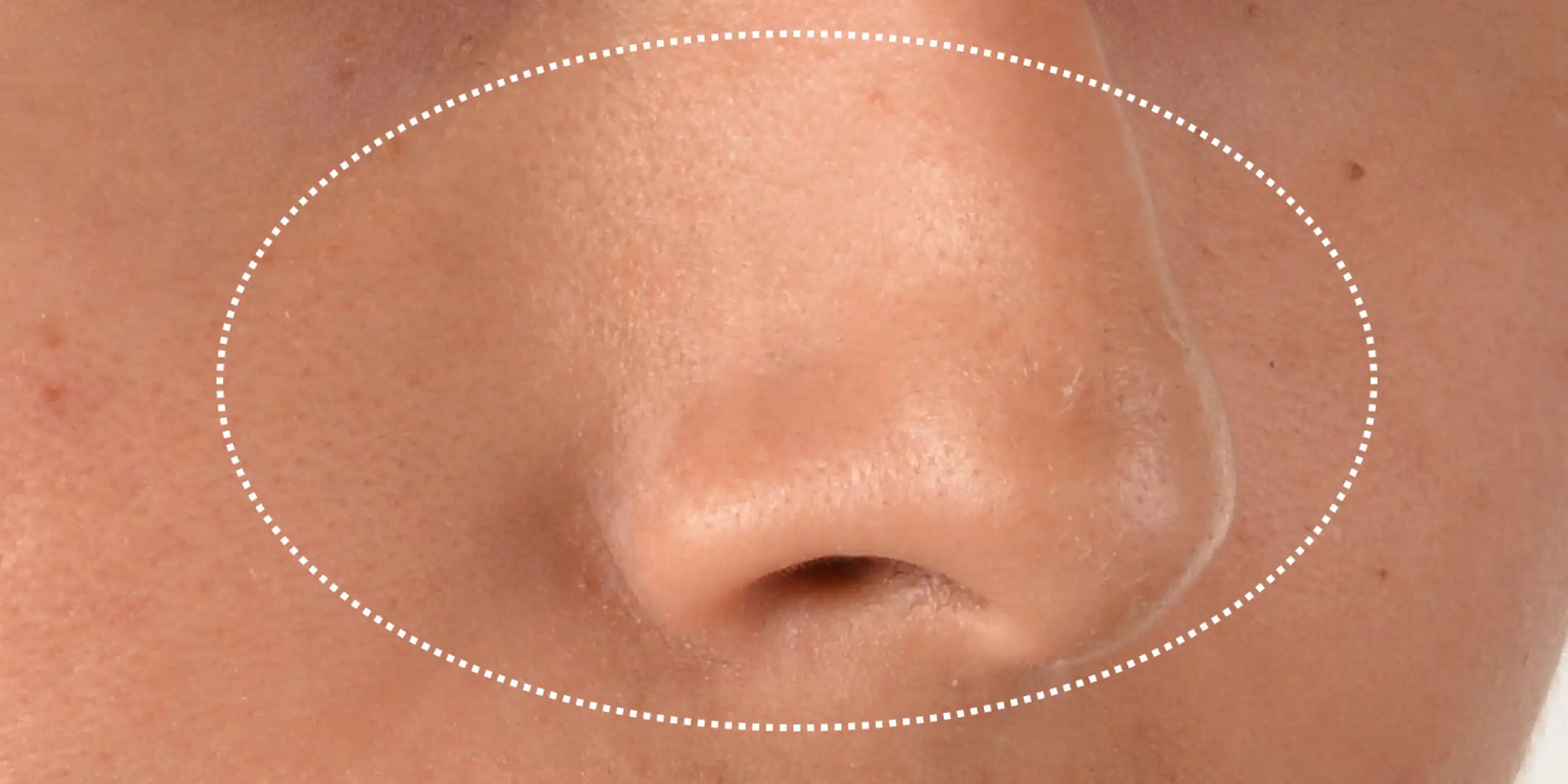 Alt text not provided for this image