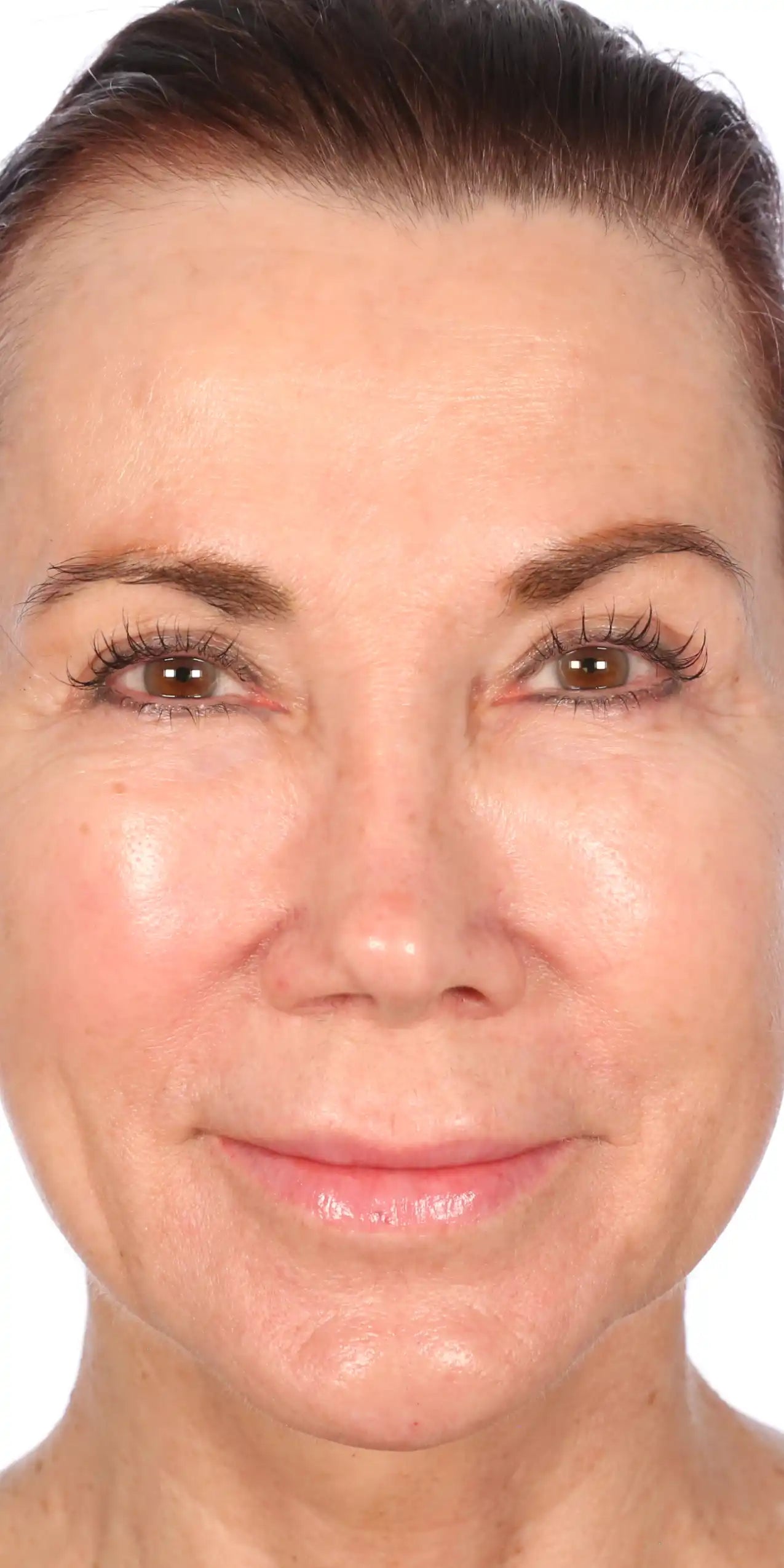 Alt text not provided for this image