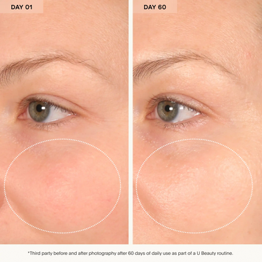 BARRIER Bioactive Treatment.
