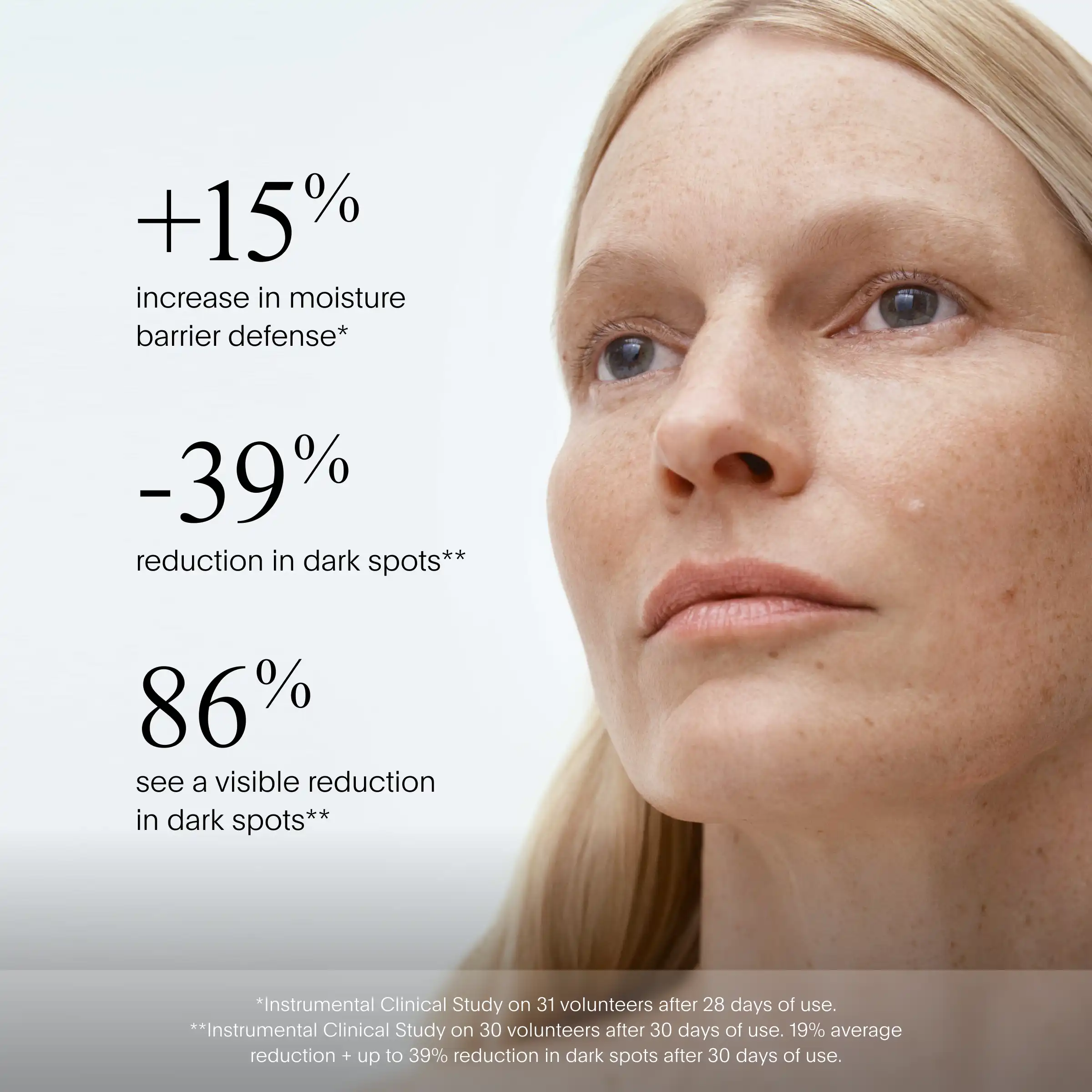 Person with fair skin and freckles facing right, with text stating moisturizer and dark spot reduction statistics.