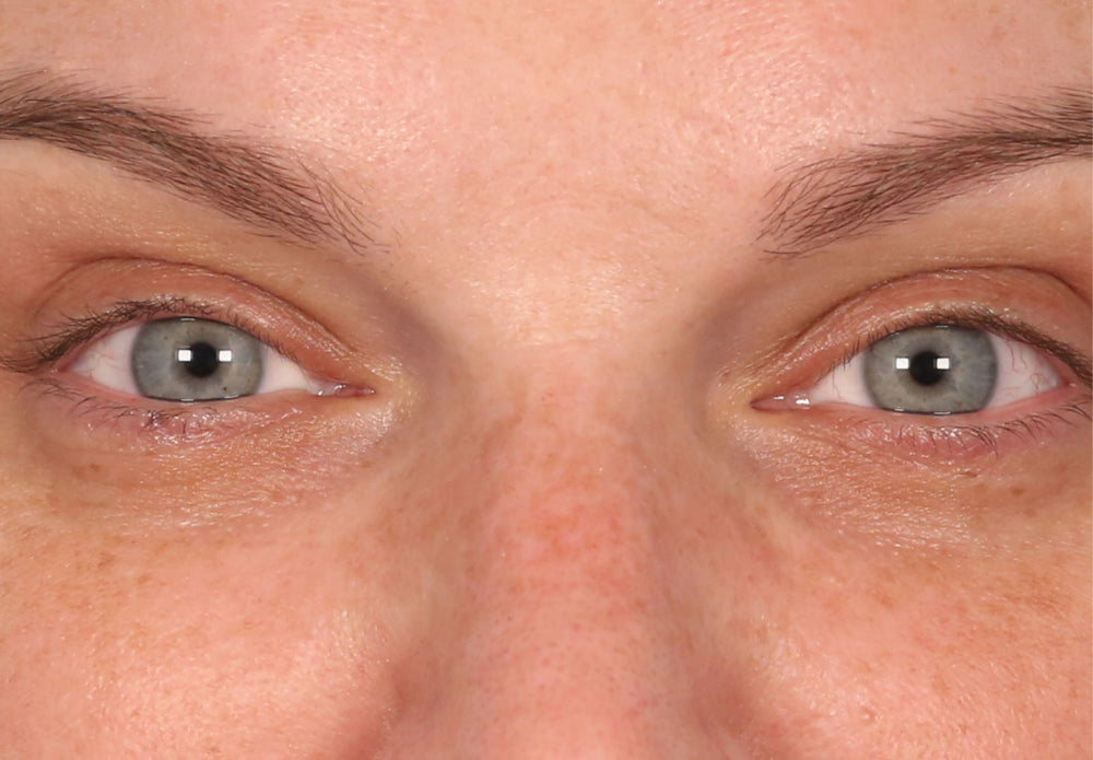 Dark Spot, Hyperpigmentation Treatment & SPF 30 | U Beauty