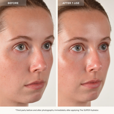 Side-by-side facial comparison showing skin appearance before and after single product application.