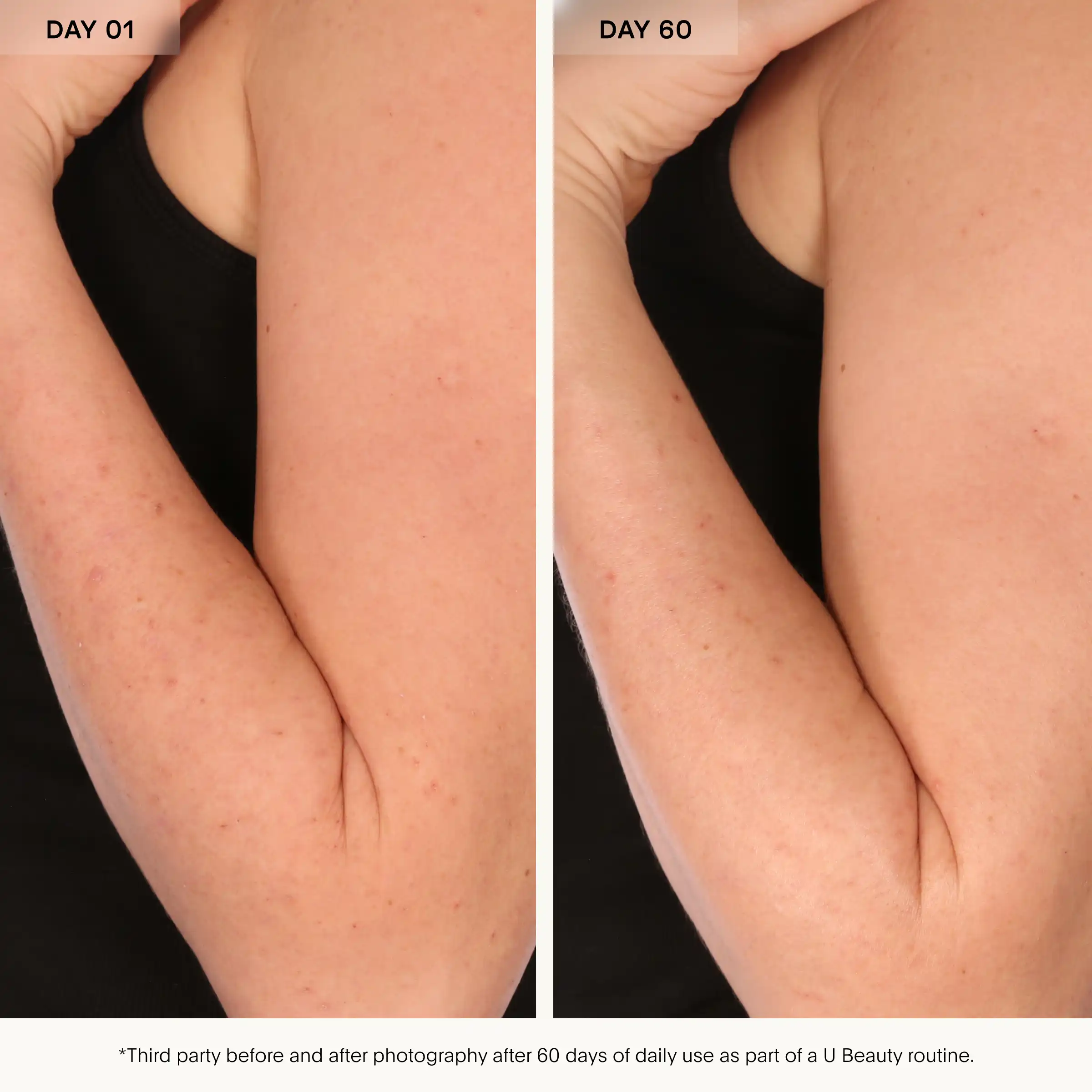 Side-by-side comparison of arm skin texture before and after 60 days of product use.