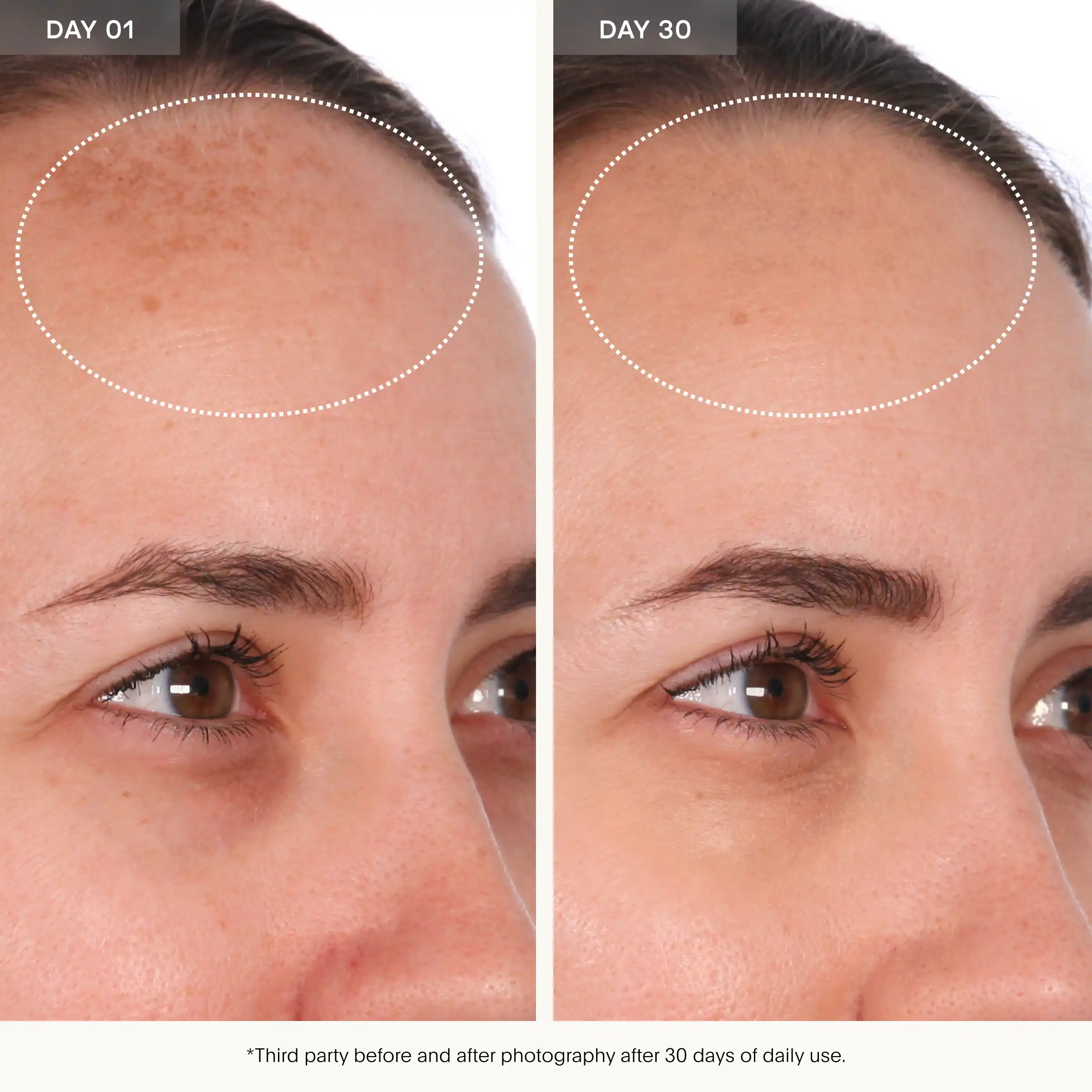 Resurfacing Compound