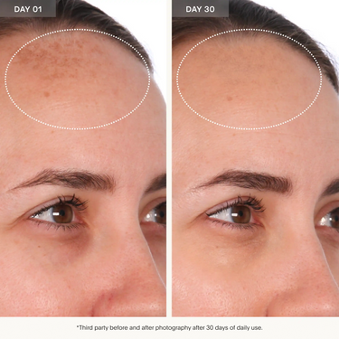 Resurfacing Serum to Brighten Skin