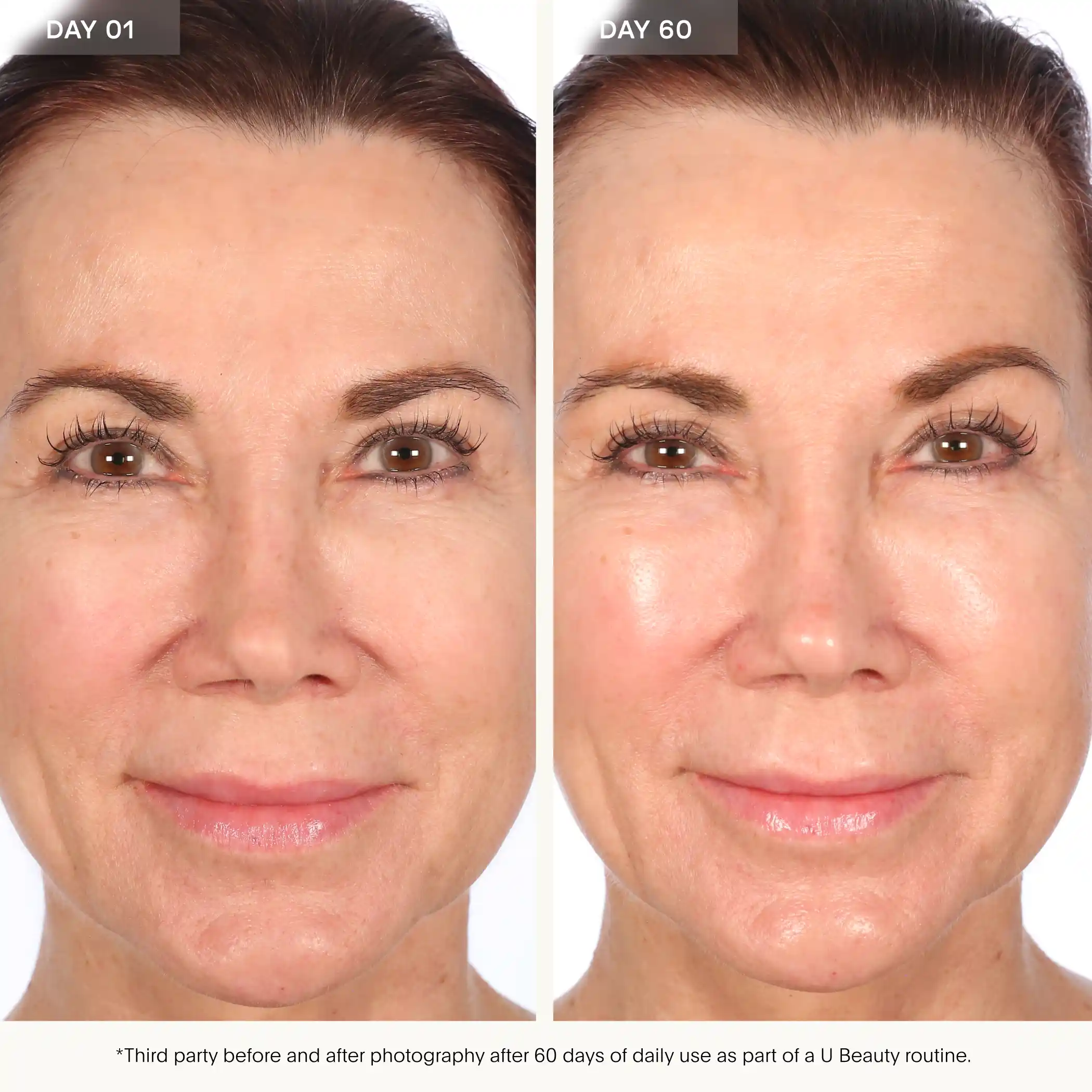 Before and after facial comparison showing skin at day 01 and day 60 of product use.