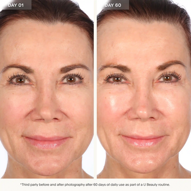 Resurfacing Flash Peel