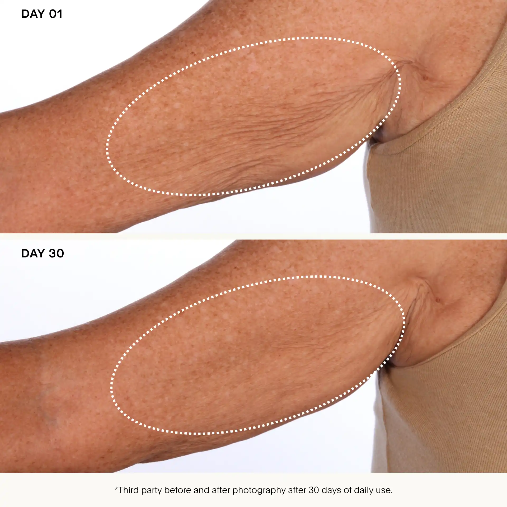 The SCULPT Arm Compound