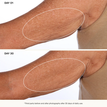 The SCULPT Arm Compound