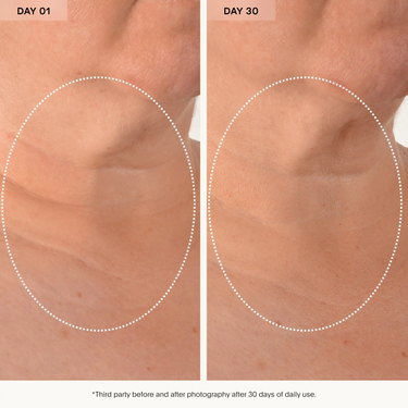 The SCULPT Neck + Décolleté Concentrate